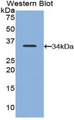 CD177 Antibody - Western blot of recombinant CD177.  This image was taken for the unconjugated form of this product. Other forms have not been tested.