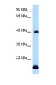 CD1D Antibody - CD1D antibody Western blot of Fetal Heart lysate. Antibody concentration 1 ug/ml.  This image was taken for the unconjugated form of this product. Other forms have not been tested.
