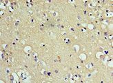 CD200R1 / CD200R Antibody - Immunohistochemistry of paraffin-embedded human brain tissue using antibody at 1:100 dilution.