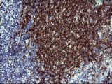 CD22 Antibody - IHC of paraffin-embedded Human lymph node tissue using anti-CD22 mouse monoclonal antibody.