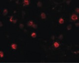 CD244 Antibody - Immunofluorescence of SLAMF4 in Daudi cells with SLAMF4 antibody at 20 ug/ml.