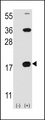 CD247 / CD3 Zeta Antibody - Western blot of CD3Z (arrow) using rabbit polyclonal CD3Z Antibody. 293 cell lysates (2 ug/lane) either nontransfected (Lane 1) or transiently transfected with the CD3Z gene (Lane 2) (Origene Technologies).