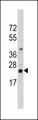 CD247 / CD3 Zeta Antibody - Western blot of anti-CD3Z Antibody (RB13817) in Ramos cell line lysates (35 ug/lane). CD3Z(arrow) was detected using the purified antibody.