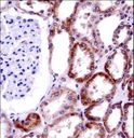 CD27L / CD70 Antibody - CD70 Antibody immunohistochemistry of formalin-fixed and paraffin-embedded human kidney tissue followed by peroxidase-conjugated secondary antibody and DAB staining.