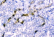 CD2AP Antibody - IHC analysis of CD2AP using anti-CD2AP antibody. CD2AP was detected in paraffin-embedded section of mouse kidney tissues. Heat mediated antigen retrieval was performed in citrate buffer (pH6, epitope retrieval solution) for 20 mins. The tissue section was blocked with 10% goat serum. The tissue section was then incubated with 1µg/ml rabbit anti-CD2AP Antibody overnight at 4°C. Biotinylated goat anti-rabbit IgG was used as secondary antibody and incubated for 30 minutes at 37°C. The tissue section was developed using Strepavidin-Biotin-Complex (SABC) with DAB as the chromogen.