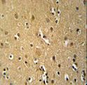 CD30 Antibody - TNFRSF8-Y479 Antibody immunohistochemistry of formalin-fixed and paraffin-embedded human brain tissue followed by peroxidase-conjugated secondary antibody and DAB staining.