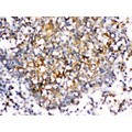 CD30L / CD153 Antibody - CD153 was detected in paraffin-embedded sections of human tonsil tissues using rabbit anti- CD153 Antigen Affinity purified polyclonal antibody at 1 ug/mL. The immunohistochemical section was developed using SABC method.