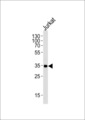 CD32A Antibody - Western blot of lysate from Jurkat cell line,using FCGR2A Antibody. Antibody was diluted at 1:1000 at each lane. A goat anti-rabbit IgG H&L (HRP) at 1:5000 dilution was used as the secondary antibody.Lysate at 35ug per lane.