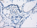 CD32A Antibody - IHC of paraffin-embedded thyroid tissue using anti-FCGR2A mouse monoclonal antibody. (Dilution 1:50).