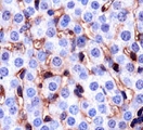 CD36 Antibody - Staining of CD36 in mouse liver.  This image was taken for the unconjugated form of this product. Other forms have not been tested.