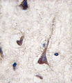CD3G Antibody - Formalin-fixed and paraffin-embedded human brain tissue reacted with CD3G antibody , which was peroxidase-conjugated to the secondary antibody, followed by DAB staining. This data demonstrates the use of this antibody for immunohistochemistry; clinical relevance has not been evaluated.