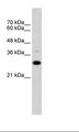 CD40 Antibody - Raji Cell Lysate.  This image was taken for the unconjugated form of this product. Other forms have not been tested.