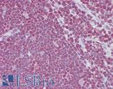 CD40L Antibody - Anti-CD40LG / CD54 antibody IHC of human thymus. Immunohistochemistry of formalin-fixed, paraffin-embedded tissue after heat-induced antigen retrieval. Antibody concentration 5 ug/ml.  This image was taken for the unconjugated form of this product. Other forms have not been tested.