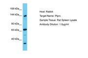 CD45 / LCA Antibody -  This image was taken for the unconjugated form of this product. Other forms have not been tested.