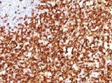 CD45RO Antibody - IHC testing of FFPE human tonsil and CD45RO antibody (clone CDLA45RO-1).  This image was taken for the unmodified form of this product. Other forms have not been tested.