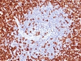 CD45RO Antibody - IHC testing of CD45RO antibody and FFPE human tonsil.  This image was taken for the unmodified form of this product. Other forms have not been tested.