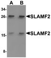 CD48 Antibody - Western blot analysis of SLAMF2 in rat lung tissue lysate with SLAMF2 antibody at (A) 1 and (B) 2 ug/ml.