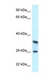 CD63 Antibody - CD63 antibody Western blot of 3 Cell lysate. Antibody concentration 1 ug/ml.  This image was taken for the unconjugated form of this product. Other forms have not been tested.