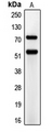 Antibody - Western blot analysis of CD66a/e expression in A549 (A) whole cell lysates.