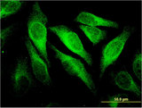 CD66c / CEACAM6 Antibody - Immunofluorescence of monoclonal antibody to CEACAM6 on HeLa cell . [antibody concentration 10 ug/ml]