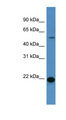 CD66d / CEACAM3 Antibody - CEACAM3 antibody Western blot of Fetal Liver lysate.  This image was taken for the unconjugated form of this product. Other forms have not been tested.