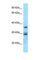 CD68 Antibody - CD68 antibody Western blot of Jurkat Cell lysate. Antibody concentration 1 ug/ml.  This image was taken for the unconjugated form of this product. Other forms have not been tested.