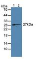 CD7 Antibody - Western Blot; Sample: Lane1: Rat Spleen Tissue; Lane2: Rat Thymus Tissue.