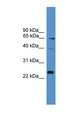 CD7 Antibody - CD7 antibody Western blot of MCF7 cell lysate. This image was taken for the unconjugated form of this product. Other forms have not been tested.