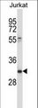 CD7 Antibody - CD7 Antibody western blot of Jurkat cell line lysates (35 ug/lane). The CD7 antibody detected the CD7 protein (arrow).