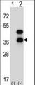 CD72 Antibody - Western blot of CD72 (arrow) using rabbit polyclonal CD72 Antibody. 293 cell lysates (2 ug/lane) either nontransfected (Lane 1) or transiently transfected (Lane 2) with the CD72 gene.