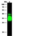 CD74 / CLIP Antibody - Anti-CD74 rabbit polyclonal antibody at 1:500 dilution. Lane A: Raji Whole Cell Lysate. Lysates/proteins at 30 ug per lane. Secondary: Goat Anti-Rabbit IgG H&L (Dylight800) at 1/10000 dilution. Developed using the Odyssey technique. Performed under reducing conditions. Predicted band size: 34 kDa. Observed band size: 34 kDa. (We are unsure as to the identity of these extra bands.)
