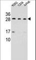 CD79A / CD79 Alpha Antibody - CD79A Antibody western blot of K562,CEM,Jurkat cell line lysates (35 ug/lane). The CD79A antibody detected the CD79A protein (arrow).