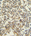 CD82 Antibody - Formalin-fixed and paraffin-embedded human lymph with CD82 (ST6) Antibody , which was peroxidase-conjugated to the secondary antibody, followed by DAB staining. This data demonstrates the use of this antibody for immunohistochemistry; clinical relevance has not been evaluated.