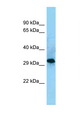 CD86 Antibody - CD86 antibody Western blot of COL0205 Cell lysate. Antibody concentration 1 ug/ml.  This image was taken for the unconjugated form of this product. Other forms have not been tested.
