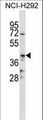 CD86 Antibody - CD86 Antibody western blot of NCI-H292 cell line lysates (35 ug/lane). The CD86 antibody detected the CD86 protein (arrow).