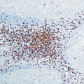 CD8A / CD8 Alpha Antibody - Formalin-fixed, paraffin-embedded human tonsil stained with peroxidase-conjugate and DAB chromogen. Note membrane staining of T cells.