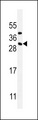 CD8B / CD8 Beta Antibody - CD8B1 Antibody western blot of MDA-MB435 cell line lysates (35 ug/lane). The CD8B1 antibody detected the CD8B1 protein (arrow).