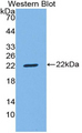 CD8B / CD8 Beta Antibody - Western Blot; Sample: Recombinant protein.