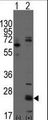 CD9 Antibody - Western blot of CD9(arrow) using rabbit polyclonal CD9 Antibody. 293 cell lysates (2 ug/lane) either nontransfected (Lane 1) or transiently transfected with the CD9 gene (Lane 2) (Origene Technologies).