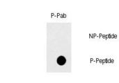 CD95 / FAS Antibody - Dot blot of Phospho-FAS-Y291 polyclonal antibody on nitrocellulose membrane. 50ng of Phospho-peptide or Non Phospho-peptide per dot were adsorbed. Antibody working concentration was 0.5ug per ml. P-antibody: phospho-antibody; P-Peptide: phospho-peptide; NP-Peptide: non-phospho-peptide.