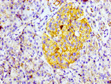 CD99 Antibody - Immunohistochemistry Dilution at 1:100 and staining in paraffin-embedded human pancreatic tissue performed on a Leica BondTM system. After dewaxing and hydration, antigen retrieval was mediated by high pressure in a citrate buffer (pH 6.0). Section was blocked with 10% normal Goat serum 30min at RT. Then primary antibody (1% BSA) was incubated at 4°C overnight. The primary is detected by a biotinylated Secondary antibody and visualized using an HRP conjugated SP system.