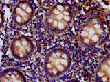 CD99L2 Antibody - Immunohistochemistry image at a dilution of 1:400 and staining in paraffin-embedded human appendix tissue performed on a Leica BondTM system.