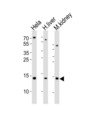 CDA / Cytidine Deaminase Antibody - Western blot of lysates from HeLa cell line, human liver and mouse kidney tissue lysate(from left to right), using CDA Antibody. Antibody was diluted at 1:1000 at each lane. A goat anti-rabbit IgG H&L (HRP) at 1:10000 dilution was used as the secondary antibody. Lysates at 35ug per lane.