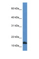 CDA / Cytidine Deaminase Antibody - CDA / Cytidine Deaminase antibody Western blot of HepG2 Cell lysate. Antibody concentration 1 ug/ml.  This image was taken for the unconjugated form of this product. Other forms have not been tested.