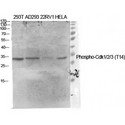 CDC2 + CDK2 + CDK3 Antibody - Western blot of Phospho-Cdk1/2/3 (T14) antibody
