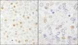 CDC20 Antibody - Detection of Human and Mouse CDC20 by Immunohistochemistry. Sample: FFPE section of human breast carcinoma (left) and mouse teratoma (right). Antibody: Affinity purified rabbit anti-CDC20 used at a dilution of 1:1000 (0.2 ug/ml).