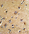 CDC23 Antibody - Formalin-fixed and paraffin-embedded human brain tissue reacted with CDC23 Antibody , which was peroxidase-conjugated to the secondary antibody, followed by DAB staining. This data demonstrates the use of this antibody for immunohistochemistry; clinical relevance has not been evaluated.