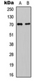 CDC25A Antibody - Western blot analysis of CDC25A expression in HeLa (A); mouse liver (B) whole cell lysates.