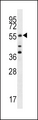 CDC25A Antibody - Cdc25A Antibody (S78) western blot of MCF-7 cell line lysates (35 ug/lane). The Cdc25A antibody detected the Cdc25A protein (arrow).