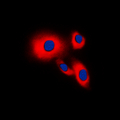CDC25B Antibody - Immunofluorescent analysis of CDC25B staining in THP1 cells. Formalin-fixed cells were permeabilized with 0.1% Triton X-100 in TBS for 5-10 minutes and blocked with 3% BSA-PBS for 30 minutes at room temperature. Cells were probed with the primary antibody in 3% BSA-PBS and incubated overnight at 4 C in a humidified chamber. Cells were washed with PBST and incubated with a DyLight 594-conjugated secondary antibody (red) in PBS at room temperature in the dark. DAPI was used to stain the cell nuclei (blue).
